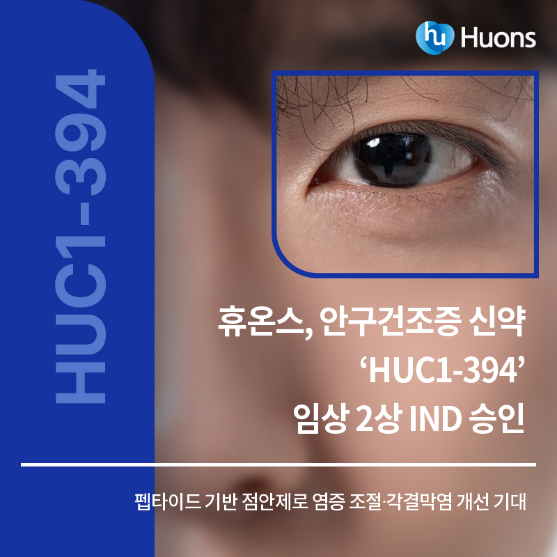 휴온스 페이스북